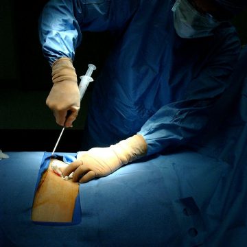 La Unidad de Hematología del hospital alcanza los 1.000 trasplantes…
