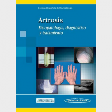 Manual sobre Artrosis: Fisiopatología, diagnóstico y tratamiento