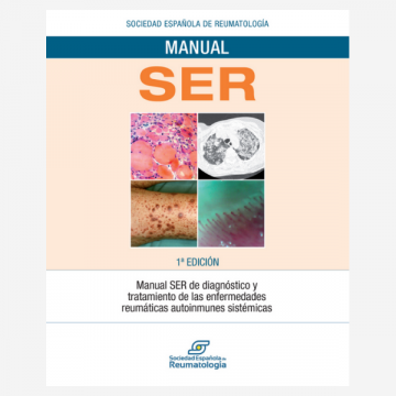 Manual SER de diagnóstico y tratamiento de las enfermedades reumáticas…
