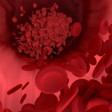 Tratan el VIH y la leucemia con glóbulos rojos modificados…