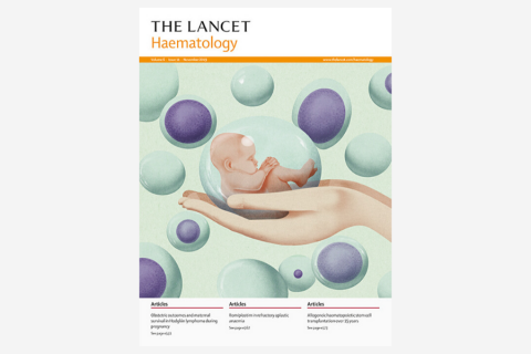 Obstetric and maternal outcomes in patients diagnosed with Hodgkin lymphoma during pregnancy: a multicentre, retrospective, cohort study