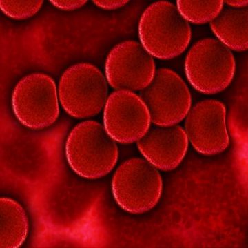 Células mutantes se unen para producir un cáncer de sangre…