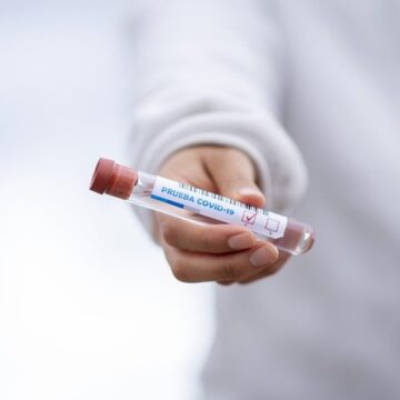 Coronavirus: eficiencia distinta en test para pacientes inmunosuprimidos