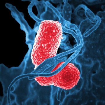 Una microbiota sana refuerza el sistema inmunitario intestinal