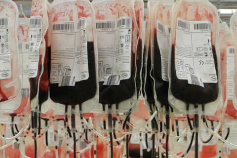 Nuevas recomendaciones internacionales para la hemofilia A adquirida