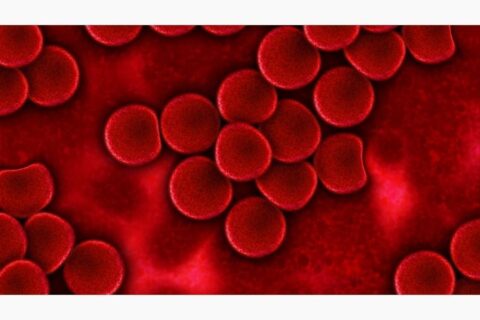 ¿Por qué la anemia es tan frecuente en nuestra sociedad actual?