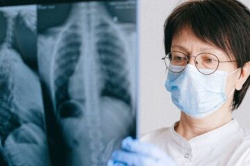 La biopsia líquida, capaz de detectar precozmente el cáncer de pulmón