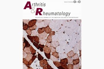 Association Between Bone Mineral Density and Autoantibodies in Patients With Rheumatoid Arthritis