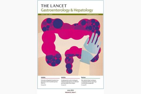Non-alcoholic fatty liver disease: a multisystem disease requiring a multidisciplinary and holistic approach
